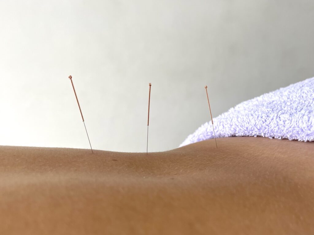 Acupuncture Back Close